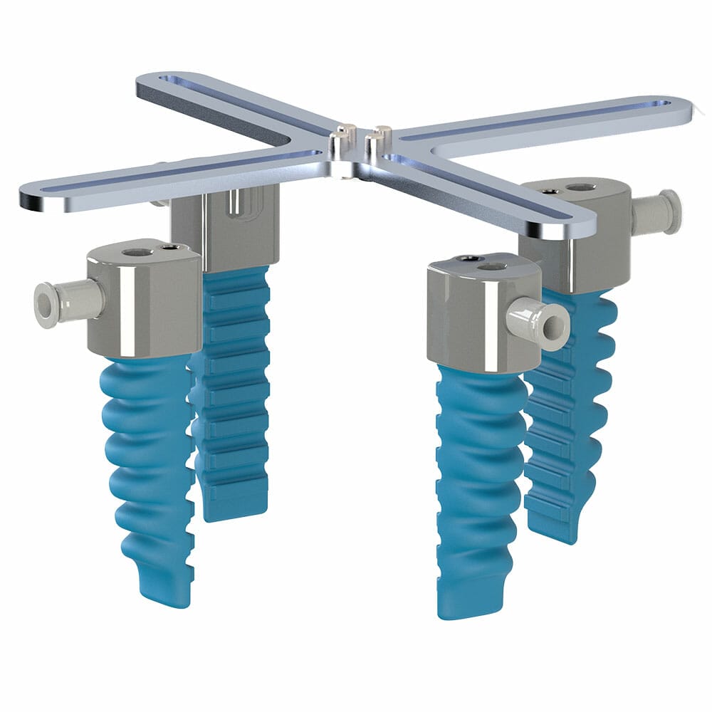 SoftActuator 1 Elements of a pneumatic gripper